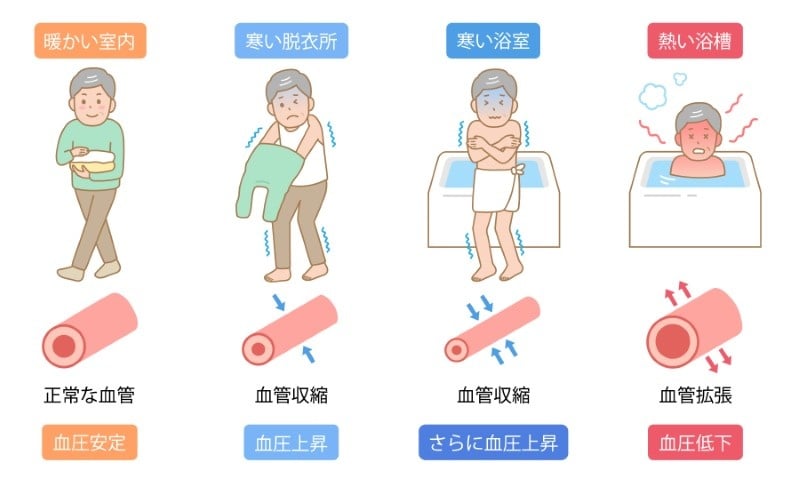 ヒートショックの模式図